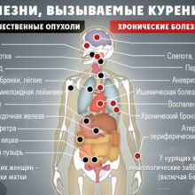 Смертельная зависимость