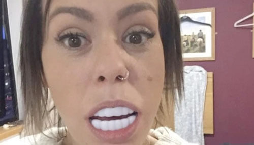 Фальшивые зубы, заказанные в интернет-магазине, оказались чрезмерно большими
